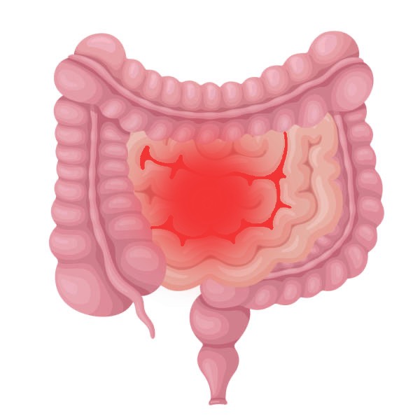 Traumatismo abdominal